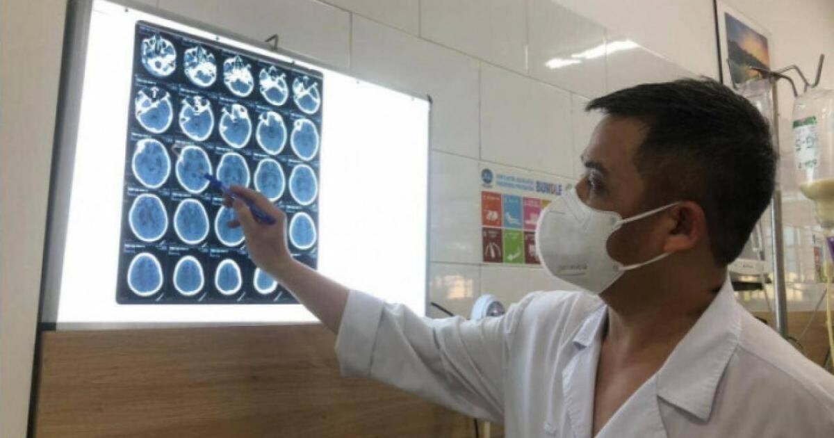Bác sỹ BV Bạch Mai đánh giá tổn thương não bệnh nhân nhiễm độc methanol tại Công ty TNHH HS Tech Vina ở Bắc Ninh. Ảnh Vũ Vũ.