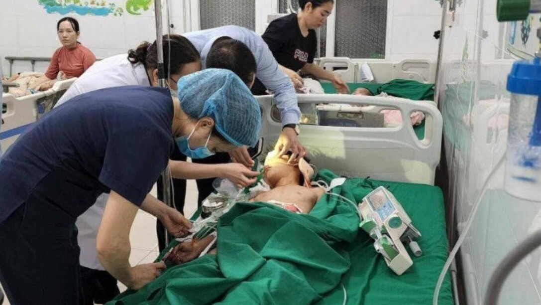Vụ nổ như bom trong gara ô tô ở Nghệ An: Xót xa một cháu nhỏ phải cưa tay