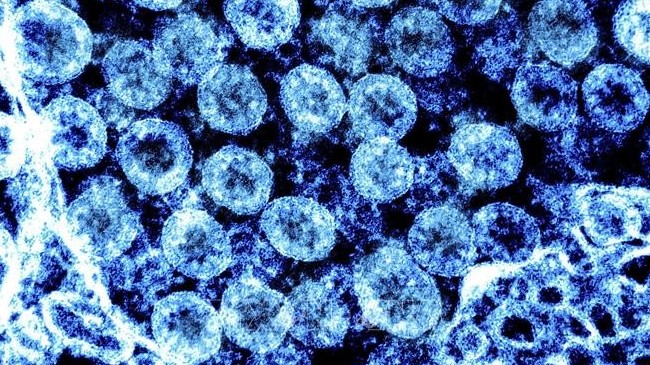 Israel phát hiện biến thể EG.5.1 của virus SARS-CoV-2
