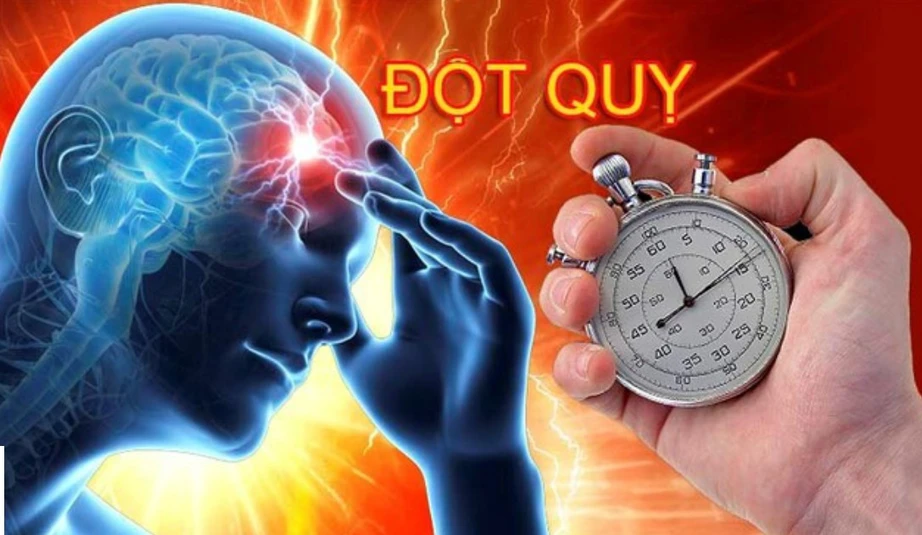 Ai có nguy cơ đột quỵ não cao?