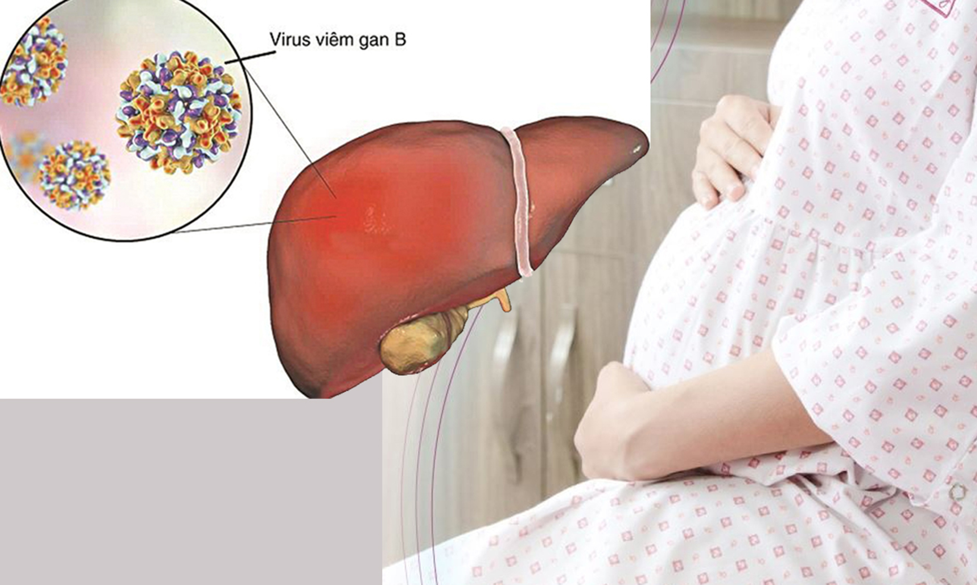 Virus viêm gan B ảnh hưởng đến thai phụ ra sao?