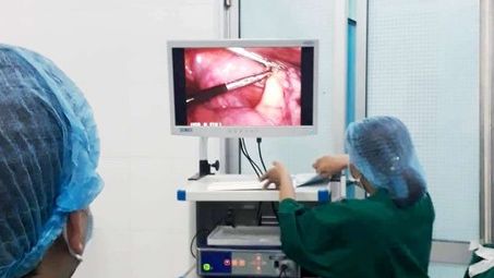 Phẫu thuật cắt ruột thừa, phát hiện thêm xương cá đâm thủng manh tràng