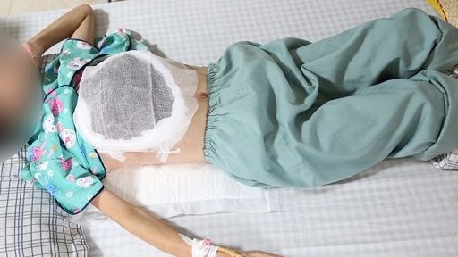 Cẩn thận khi dùng thuốc nam chữa ung thư