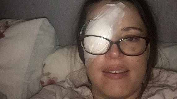 Người phụ nữ bị ung thư mắt, có nguy cơ phải khoét bỏ