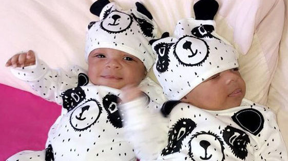 Cặp song sinh vừa chào đời đã bị ung thư máu, một bé qua đời ngay sau đó