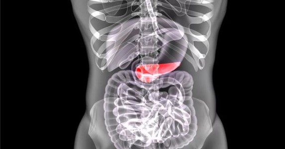 Những thói quen ăn uống gây 7 bệnh ung thư phổ biến nhất hiện nay