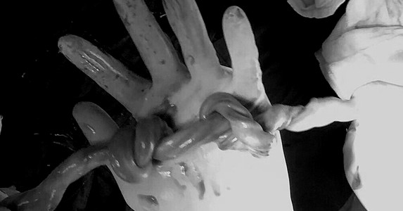 Bé gái chào đời với dây rốn thắt 2 nút