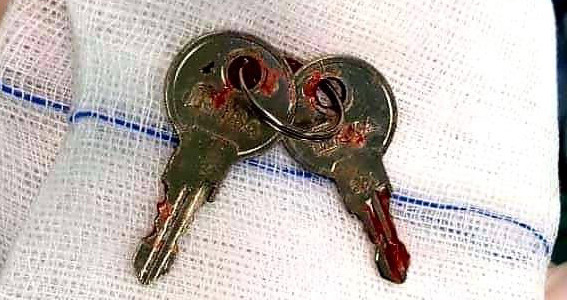 Bé trai nuốt chùm chìa khóa theo trò ảo thuật