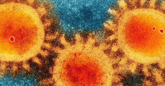 Covid-19 gây chết người ở mức độ nào?