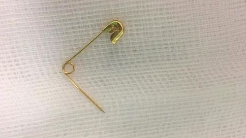 Bé 4 tuổi bị kim băng cắm vào thực quản