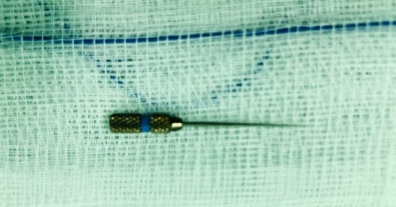 Đi chữa răng bị cây kim nha khoa rơi vào dạ dày