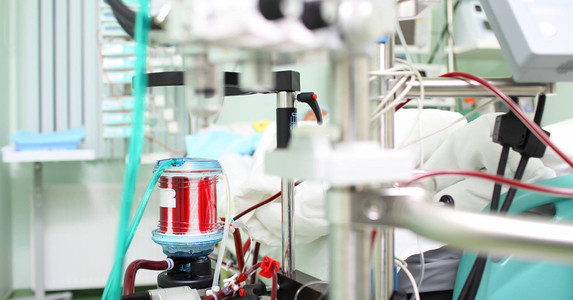 Bác gái của 'bệnh nhân 17' phải can thiệp ECMO