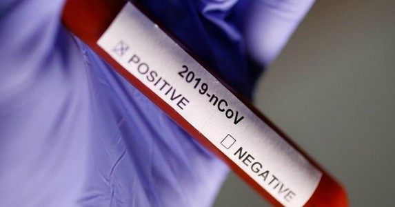 Tăng tốc xét nghiệm nCoV