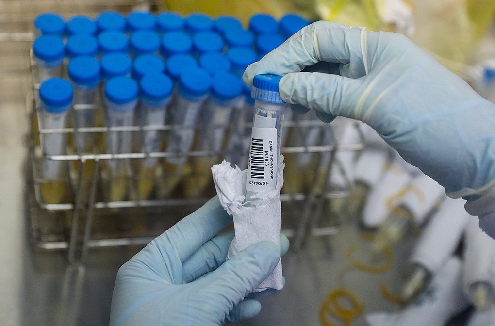 Bệnh nhân phi công Anh âm tính nCoV