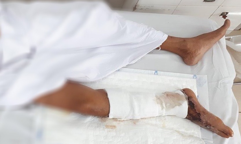 Suýt chết vì ăn gỏi cá