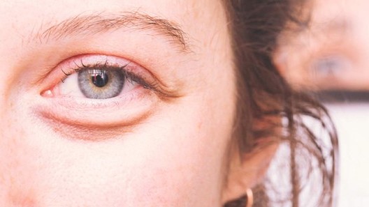 8 dấu hiệu trên khuôn mặt để lộ sức khỏe của bạn