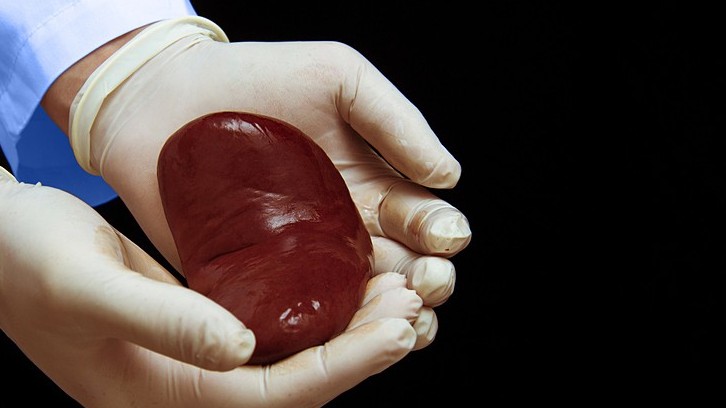 Bé gái có ba quả thận