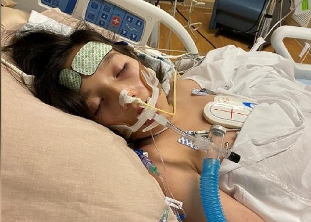 Bé gái suýt chết do hội chứng hiếm gặp liên quan Covid-19