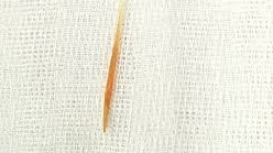 Cây tăm chui vào bụng đâm thủng hậu môn