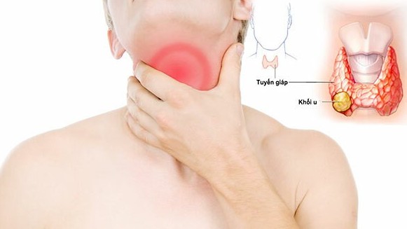 U giáp khổng lồ