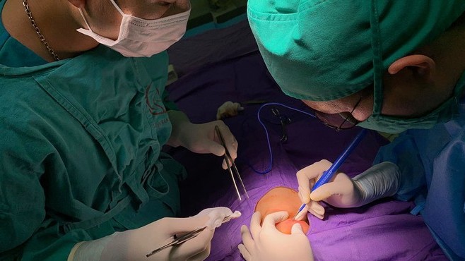 Bé hai tháng tuổi bị áp xe hàm