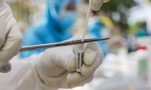 Bé một tuổi nhiễm nCoV bớt tiêu chảy