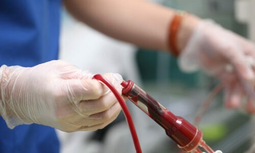 Thuyên tắc ối - tai biến sản khoa chết người