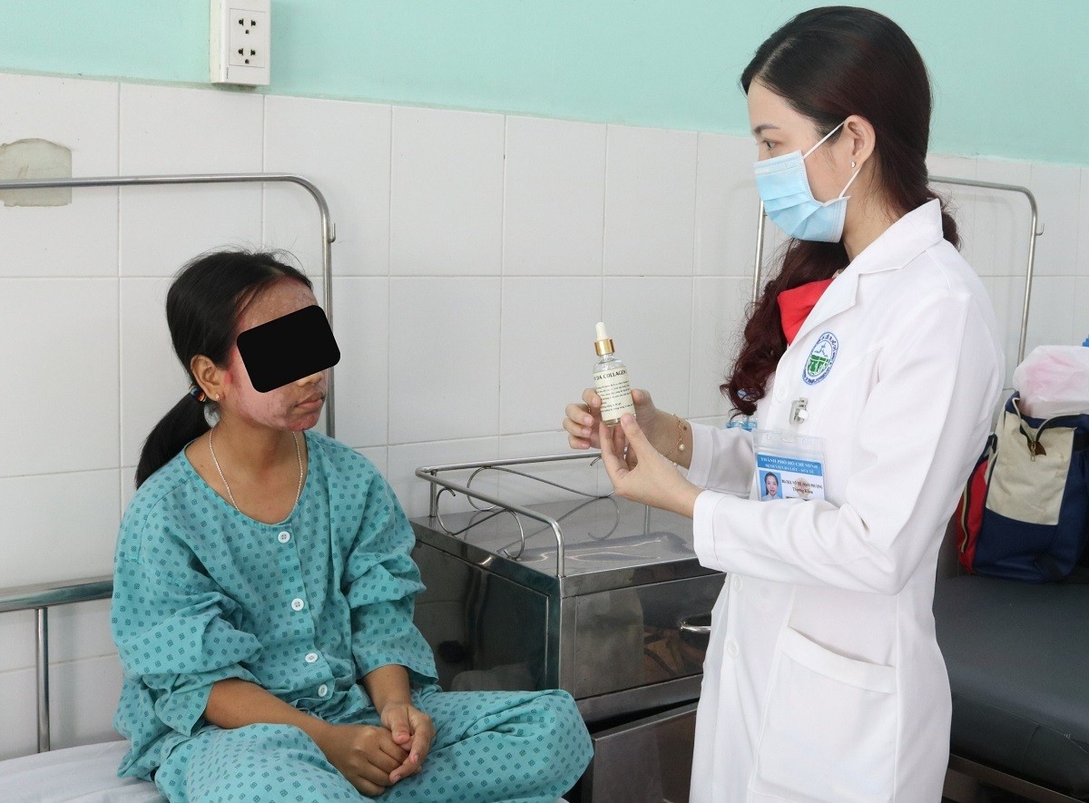 Thiếu nữ 17 tuổi mặt sưng phù, lở loét do dùng kem lột trắng da cấp tốc. Ảnh: BSCC