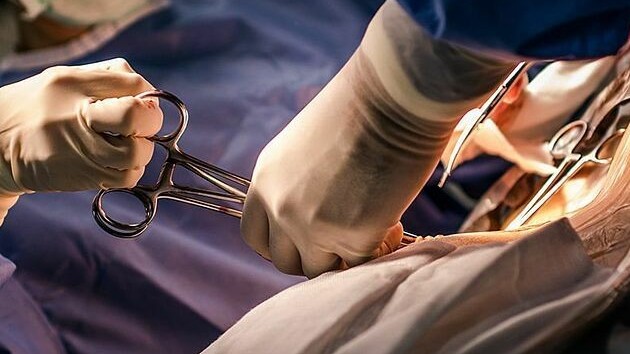 Tử cung sản phụ xoắn 180 độ