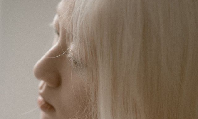 Bạch tạng - bệnh rối loạn gene không thể chữa khỏi