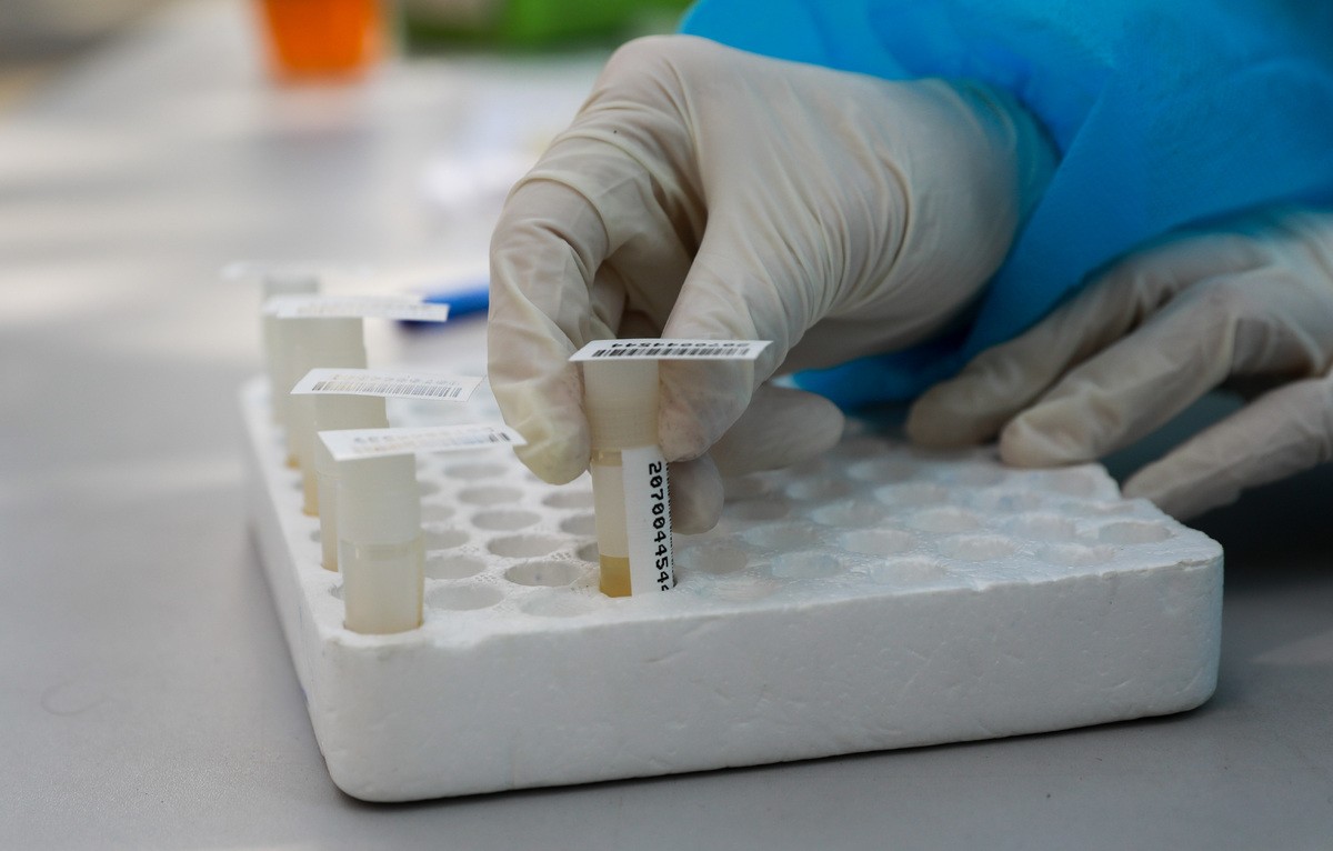 'Bệnh nhân 325' tái dương tính nCoV sau xuất viện