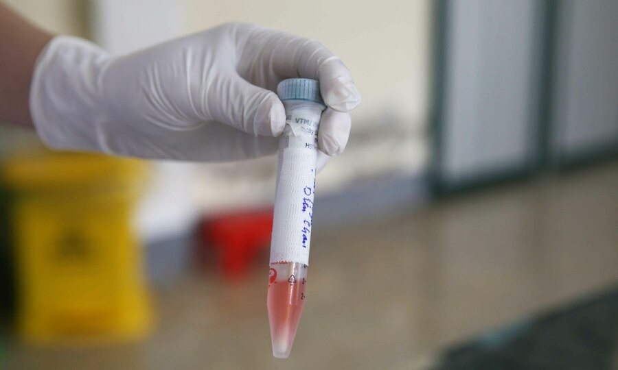 Bé trai một tuổi khỏi Covid-19