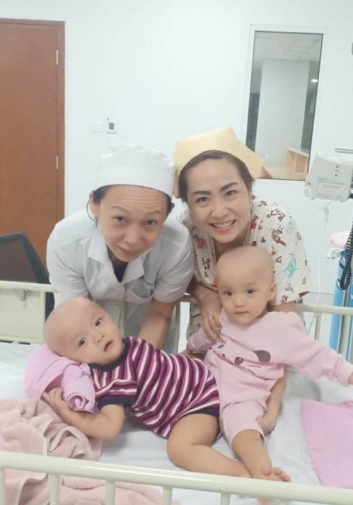 Những lần 'thót tim' nữ điều dưỡng chăm sóc hai bé dính nhau