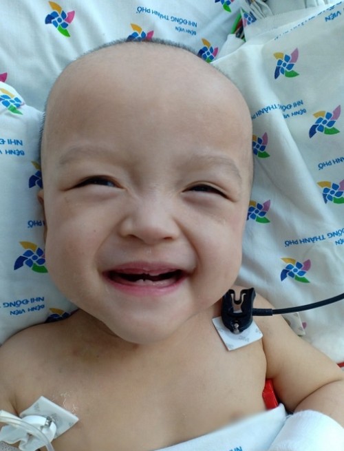 Sau 19 ngày cạo sạch tóc để phẫu thuật, tóc Diệu Nhi đã mọc lại. Ảnh Nguyễn Lan Anh