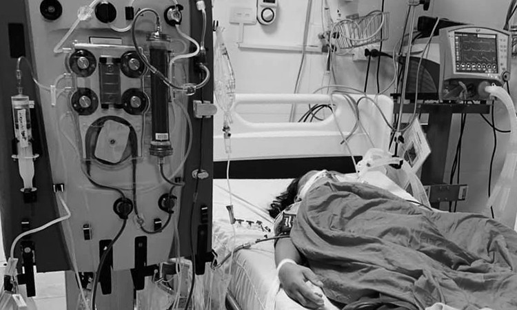 Bệnh nhân lọc máu liên tục tại khoa Hồi sức tích cực, bệnh viện Đa khoa Hà Đông. Ảnh: Bệnh viện cung cấp