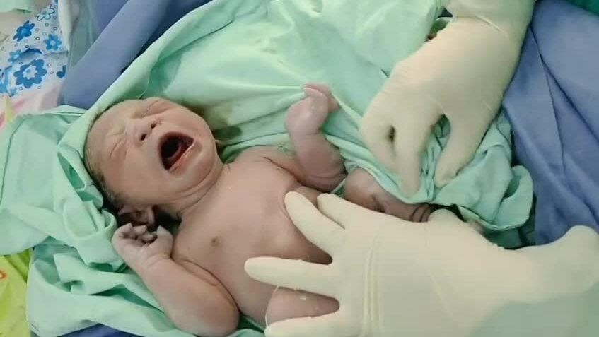 Sản phụ có hai tử cung