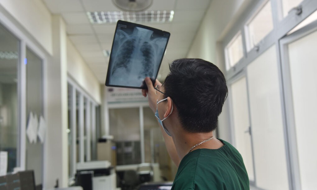 Bác sĩ Phúc xem phim X-quang phổi của bệnh nhân 1045. Ảnh: Thy Hạt.