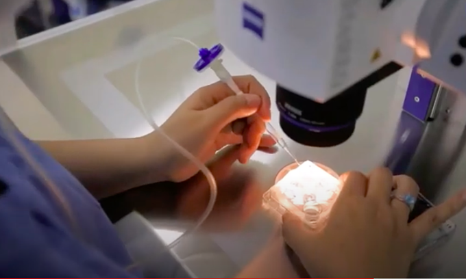 Tuổi đôi mươi đã suy buồng trứng