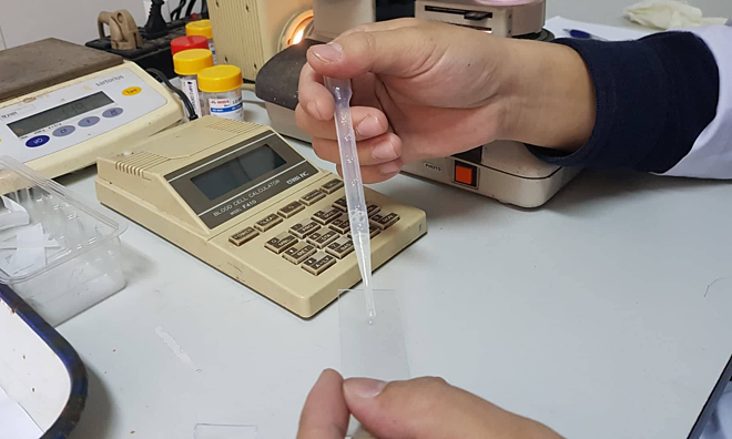 'Gửi' tinh trùng chờ ngày làm cha