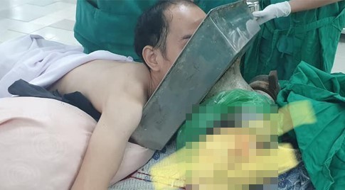 Nam thanh niên vào viện với cối xay thịt cuốn cánh tay ngập đến vai