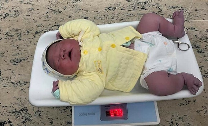 Bé trai chào đời nặng 5,75 kg. Ảnh: Bệnh viện cung cấp