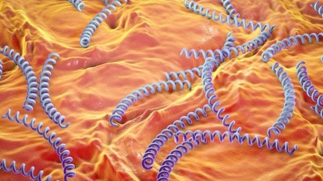 Chàng trai bị giang mai ở tai