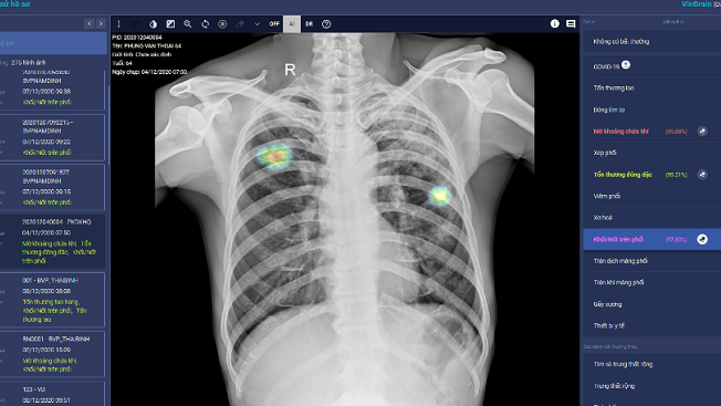 Công nghệ AI giải 'nỗi đau' ngành y tế