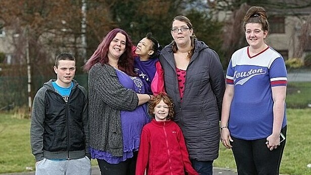 Hội chứng Marfan khiến bé 11 tuổi cao 1,8 m