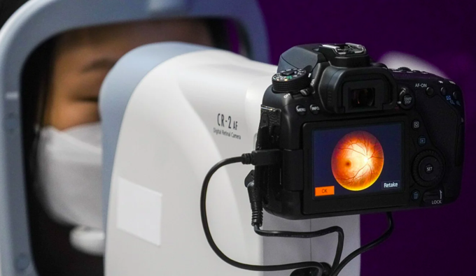 Thiết bị chụp và phân tích võng mạc để chẩn đoán tự kỷ. Ảnh: SCMP