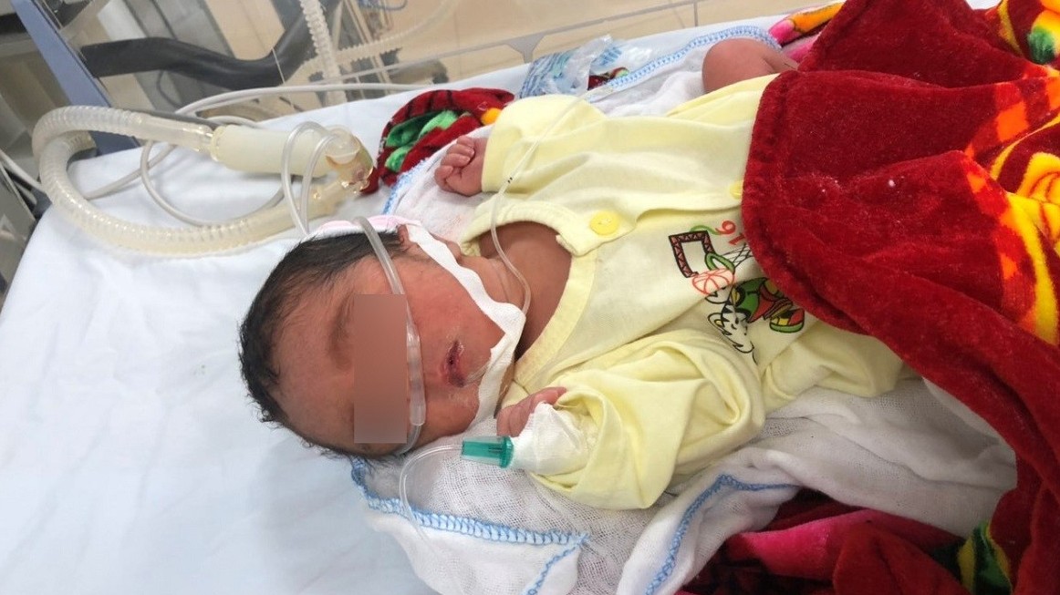 Mẹ cạn sạch nước ối ở tuần thai 23, em bé vẫn chào đời khỏe mạnh