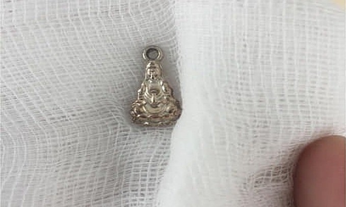 Bé gái nhét mặt dây chuyền vào vùng kín