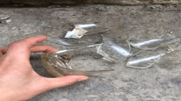 Bé Hà Nội 1 tuổi rách thành bụng do ngã vào cốc thủy tinh vỡ