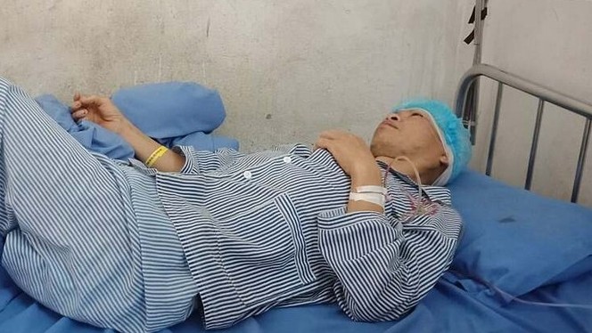 Chấn thương sọ não mà không biết