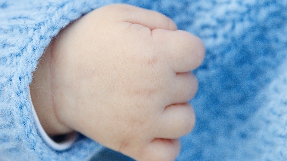 Em bé đầu tiên trên thế giới có ba dương vật